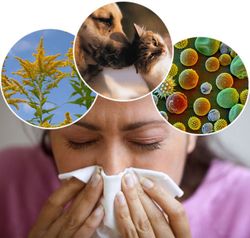 types-of-allergies.jpg